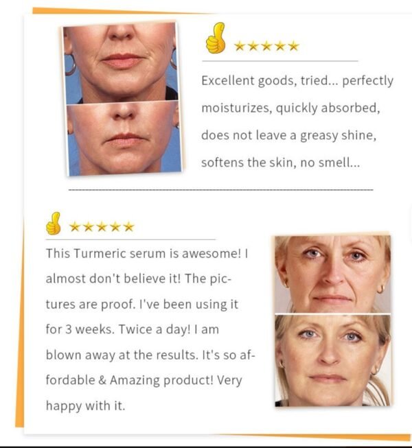 Beauty Lights Turmeric Serum - Image 4